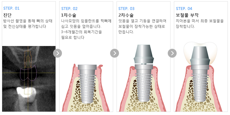 이미지명