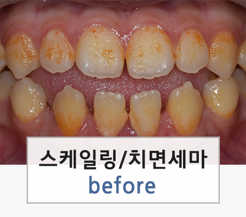 이미지명