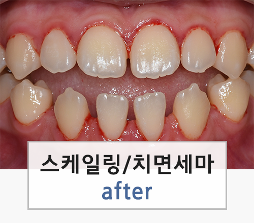 이미지명
